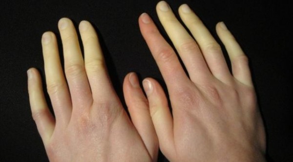 Jangan Abaikan, 5 Tanda Tubuh Anda Dalam Bahaya